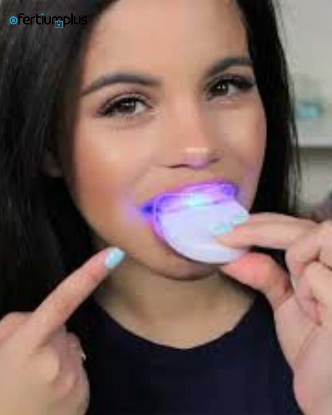 Kit De Blanqueamiento Dental